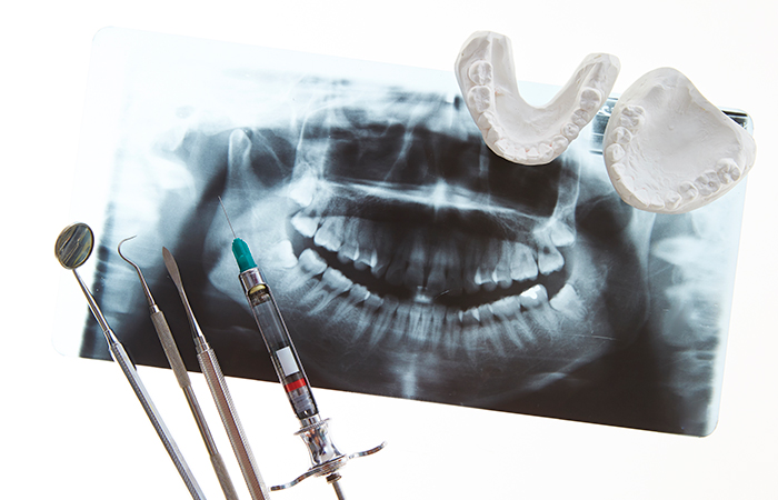 歯科口腔外科とは