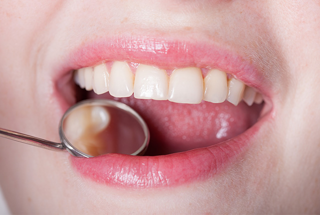 「なるべく削らない・抜かない治療」